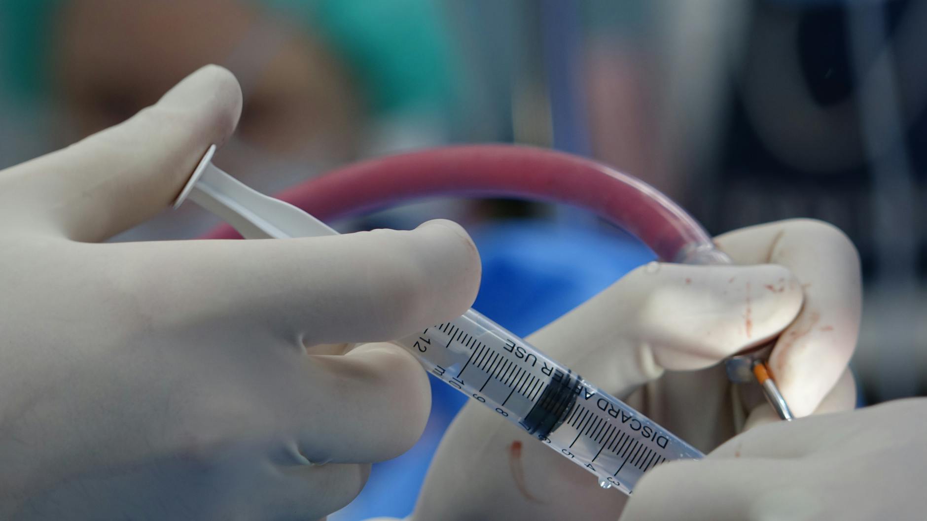 Surgeon's hands handling syringe during a medical procedure in a sterile operating room.