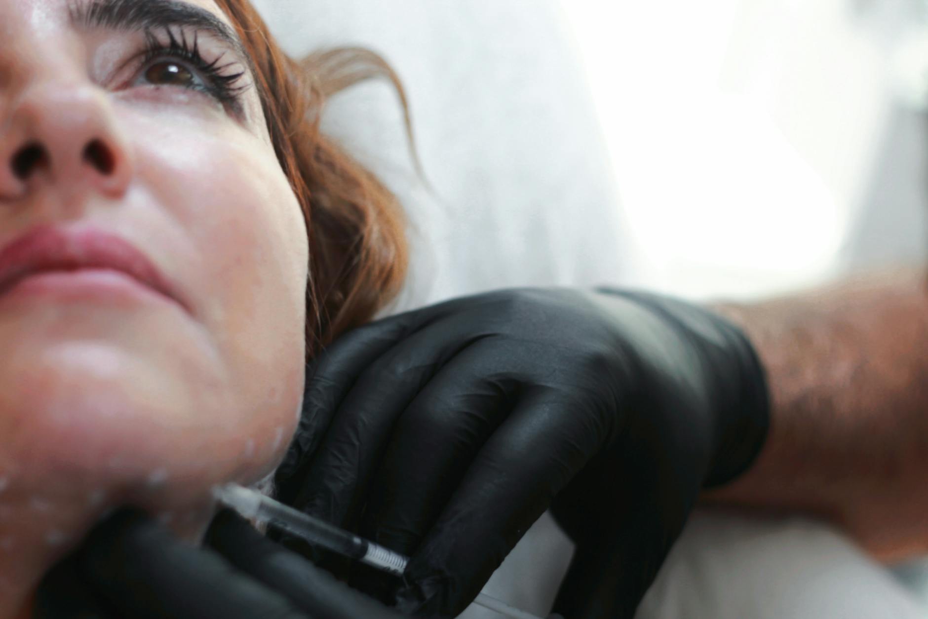 Close-up of a woman receiving dermal filler injection by professional in black gloves.