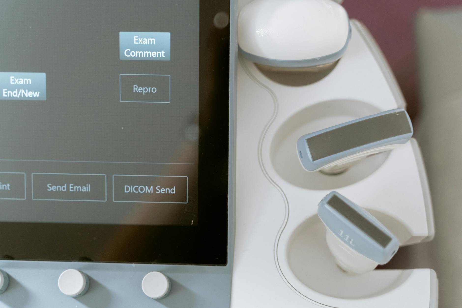 Close-up image of ultrasound equipment showing the monitor and probe holders.