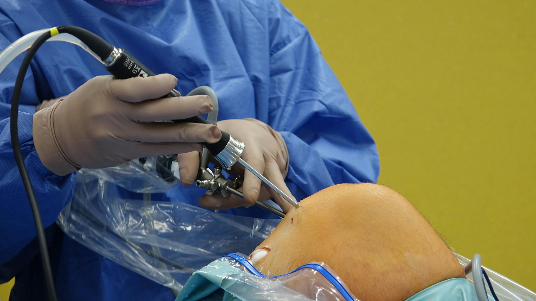 Surgeon using arthroscope for precise knee surgery in operating room.