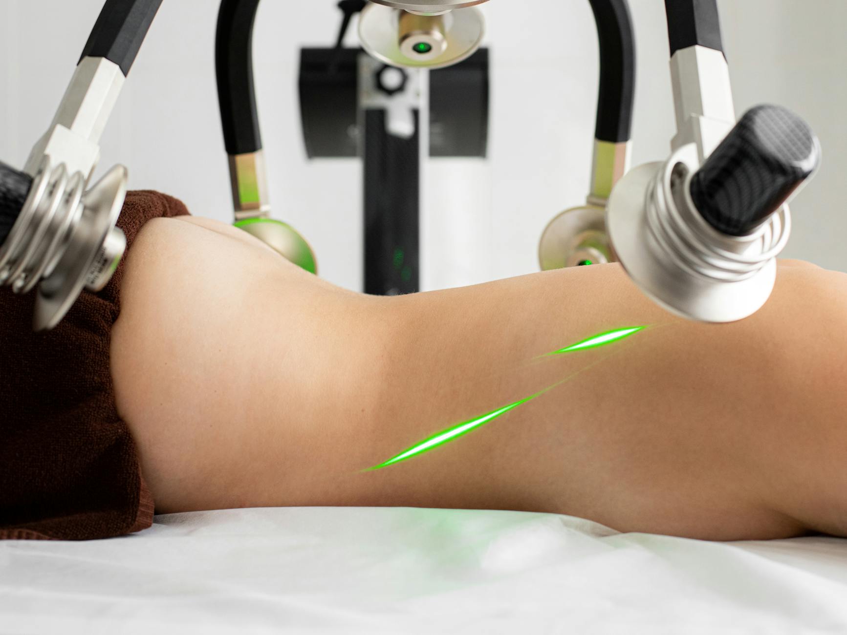 Crop unrecognizable topless female client lying under lasers of modern fat loss machine with heads during procedure in light medical clinic