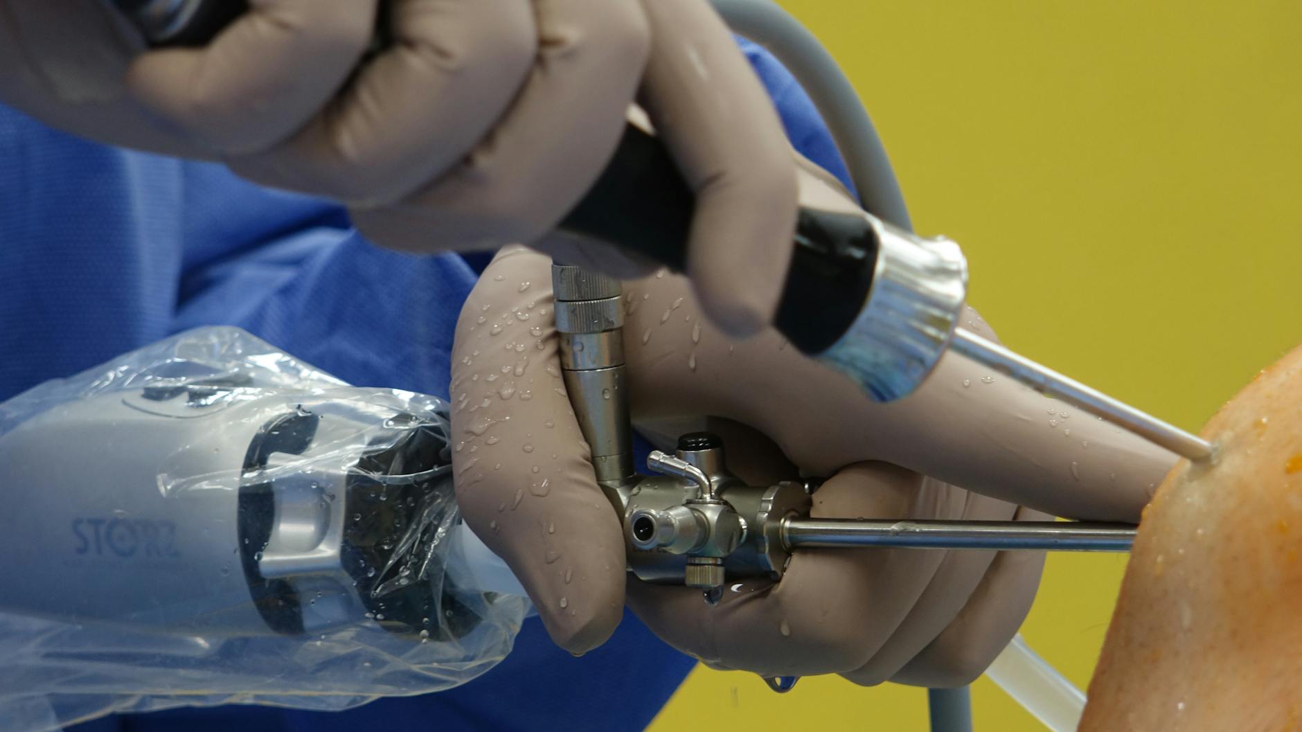 Detailed view of a surgeon performing arthroscopic knee surgery using specialized equipment.